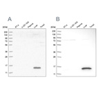 Western blot analysis using Anti-RIDA antibody HPA022856 (A) shows similar pattern to independent antibody HPA023489 (B).
