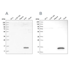 Western blot analysis using Anti-RIDA antibody HPA022856 (A) shows similar pattern to independent antibody HPA023489 (B).