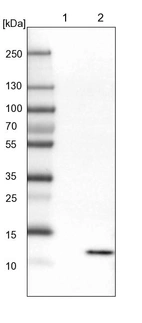Lane 1: Mouse liver tissue lysate_br/_Lane 2: Rat liver tissue lysate