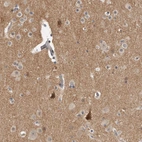Anti-KCNIP1 Antibody