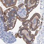 Anti-JAKMIP3 Antibody