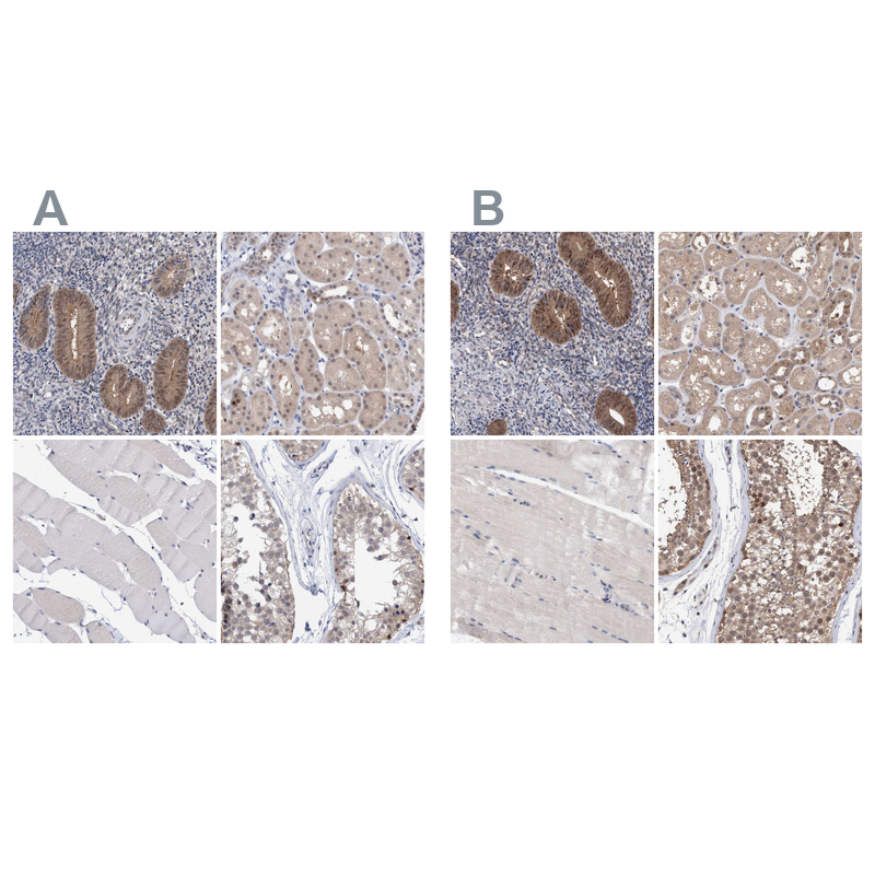 Anti-PFAS Antibody