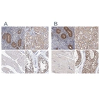 Anti-PFAS Antibody