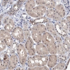 Immunohistochemical staining of human kidney shows moderate cytoplasmic positivity in cells in tubules with weak nucleus positivity.