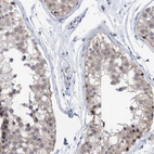 Immunohistochemical staining of human testis shows moderate cytoplasmic positivity in cells in seminiferous ducts with weak nucleus positivity.