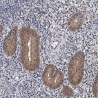 Immunohistochemical staining of human endometrium shows moderate cytoplasmic positivity in glandular cells with weak nucleus positivity.