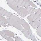 Immunohistochemical staining of human skeletal muscle shows no positivity in myocytes.