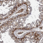 Anti-STXBP4 Antibody
