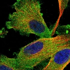 Immunofluorescent staining of human cell line U-251 MG shows localization to plasma membrane & cytosol.