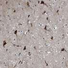 Anti-RAP1GAP2 Antibody