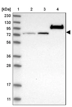 Lane 1: Marker [kDa] 230, 130, 95, 72, 56, 36, 28, 17, 11_br/_Lane 2: Human cell line RT-4_br/_Lane 3: Human cell line U-251MG sp_br/_Lane 4: Human plasma (IgG/HSA depleted)