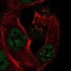 Immunofluorescent staining of human cell line EFO-21 shows localization to nucleoplasm & vesicles.