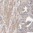 Immunohistochemical staining of human prostate shows weak to moderate cytoplasmic positivity in smooth muscle cells.