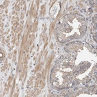 Immunohistochemical staining of human prostate shows weak to moderate cytoplasmic positivity in smooth muscle cells.