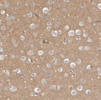 Immunohistochemical staining of human cerebral cortex shows moderate cytoplasmic positivity in neuropil.