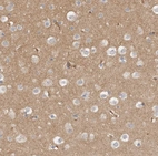 Immunohistochemical staining of human cerebral cortex shows moderate cytoplasmic positivity in neuropil.