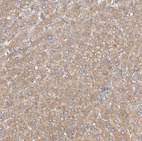 Immunohistochemical staining of human liver shows moderate cytoplasmic positivity in hepatocytes.
