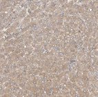 Immunohistochemical staining of human liver shows moderate cytoplasmic positivity in hepatocytes.