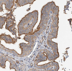 Immunohistochemical staining of human Fallopian tube shows moderate positivity in apical membrane in glandular cells.