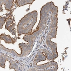 Immunohistochemical staining of human Fallopian tube shows moderate positivity in apical membrane in glandular cells.
