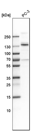 Western blot analysis in human cell line PC-3.