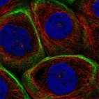 Immunofluorescent staining of human cell line A-431 shows localization to actin filaments.