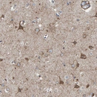 Immunohistochemical staining of human cerebral cortex shows moderate to strong cytoplasmic positivity in neurons.