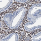 Immunohistochemical staining of human endometrium shows moderate to strong cytoplasmic positivity in stromal cells.