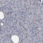 Immunohistochemical staining of human pancreas shows no positivity in exocrine glandular cells as expected.