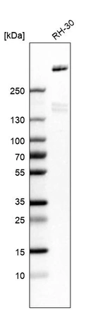 Western blot analysis in human cell line RH-30.