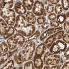 Immunohistochemical staining of human kidney shows strong granular cytoplasmic positivity in cells in tubules.