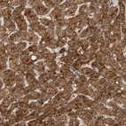 Immunohistochemical staining of human liver shows strong granular cytoplasmic positivity in hepatocytes.