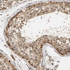 Immunohistochemical staining of human testis shows moderate granular cytoplasmic positivity in cells in seminiferous ducts.