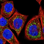 Immunofluorescent staining of human cell line A-431 shows localization to peroxisomes.