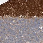 Immunohistochemical staining of human cerebellum shows strong cytoplasmic positivity in neuropil.