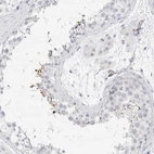 Immunohistochemical staining of human testis shows moderate cytoplasmic positivity in spermatids.