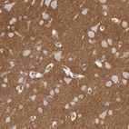 Immunohistochemical staining of human cerebral cortex shows strong cytoplasmic positivity in neuropil.