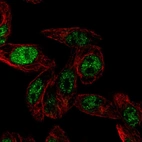 Immunofluorescent staining of human cell line Hep G2 shows localization to nucleoplasm.