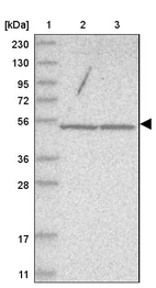 Lane 1: Marker [kDa] 230, 130, 95, 72, 56, 36, 28, 17, 11_br/_Lane 2: Human cell line RT-4_br/_Lane 3: Human cell line U-251MG sp