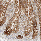 Immunohistochemical staining of human small intestine shows moderate cytoplasmic positivity in glandular cells.