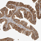 Immunohistochemical staining of human Fallopian tube shows moderate cytoplasmic positivity in glandular cells.
