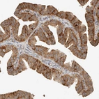 Immunohistochemical staining of human Fallopian tube shows moderate cytoplasmic positivity in glandular cells.