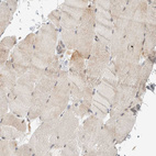 Immunohistochemical staining of human skeletal muscle shows very weak cytoplasmic positivity in myocytes as expected.