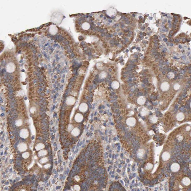 Anti-TOM1L1 Antibody