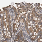 Anti-TOM1L1 Antibody