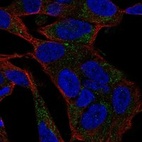 Anti-CACNA1B Antibody