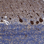 Anti-TXNDC17 Antibody