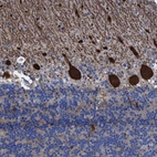 Anti-TXNDC17 Antibody