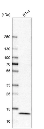 Western blot analysis in human cell line RT-4.