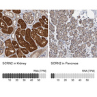 Anti-SCRN2 Antibody